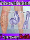 Eliminate vasculitis, phlebitis, relieve spider leg pain, varicose veins painless treatment