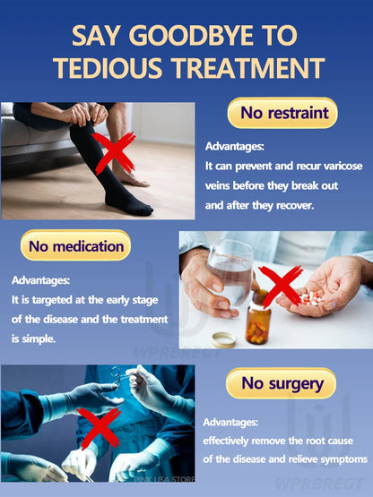 Eliminate vasculitis, phlebitis, relieve spider leg pain, varicose veins painless treatment