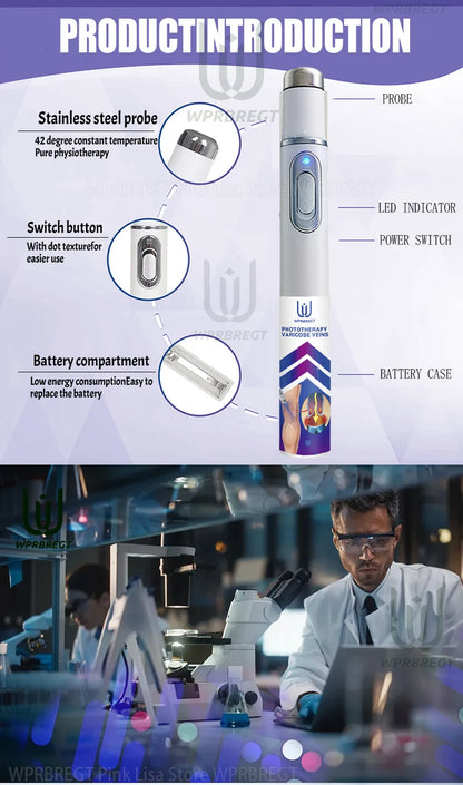 Eliminate vasculitis, phlebitis, relieve spider leg pain, varicose veins painless treatment