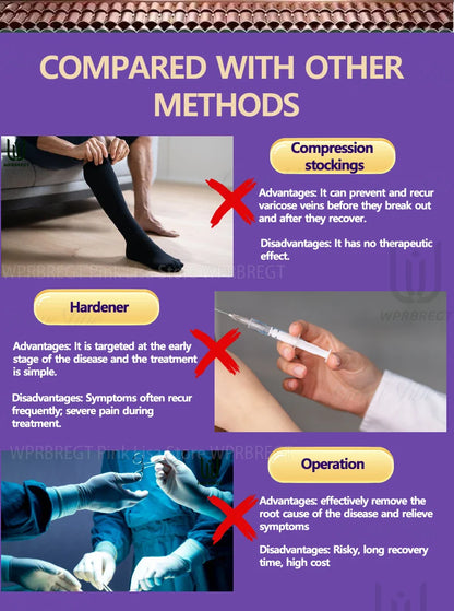 Eliminate vasculitis, phlebitis, relieve spider leg pain, varicose veins painless treatment