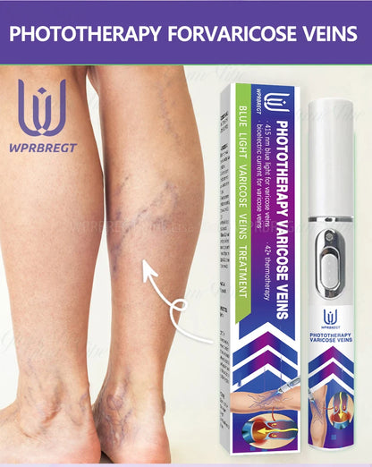 Eliminate vasculitis, phlebitis, relieve spider leg pain, varicose veins painless treatment